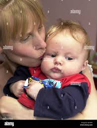 Fox Attacks baby Louise Day Stock Photo