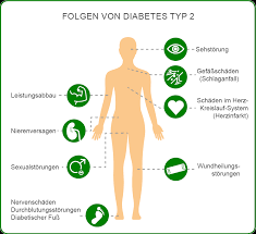Naturliche Kurkuma Knolle Bei Diabetes Mellitus Pradiabetes