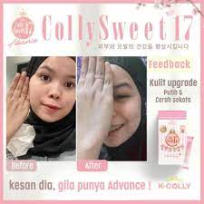 Skin whitening & health supplement. Original K Colly Sweet 17 By Lady Boss Rafa Shopee Malaysia