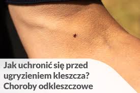 Rozsianie się boreliozy może powodować także wystąpienie objawów ogólnych infekcji takich jak nieleczona borelioza może prowadzić do poważnych konsekwencji. Preparaty Na Kleszcze Jak Uchronic Sie Przed Kleszczami Apteka Internetowa E Medest Pl