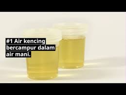 Warna Air Mani Semen Colour Kenapa Sperma Kuning Doctoroncall
