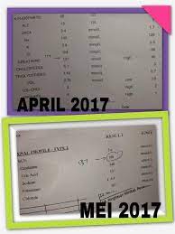 Masalah mata, yang boleh mengakibatkan kehilangan penglihatan (buta) Bacaan Bp Abah Tidak Pernah Normal Dari 2015 2017 Bacaan Buah Pinggang Pulak Semakin Teruk Natrah Mohamed Pakar Sihat Kurus Cantik