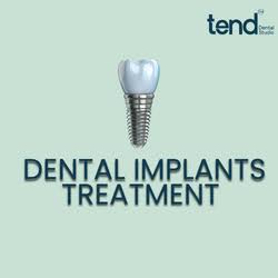 Dental Implants in Jubilee Hills, Hyderabad product image
