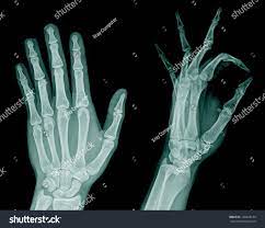 Can you imagine your surprise if gregory house got your case and became your doctor? X Ray Hand Ad Affiliate Ray Hand Photo Editing X Ray Pattern Drawing