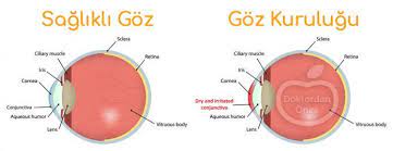 Saglikli Goz Goz Kurulugu Ciliary Muscle Body Muscle