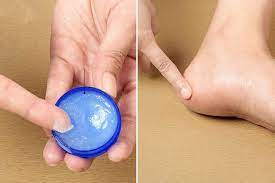 Vicks Nasil Ve Nerede Kullanilir Saglik Paylasimlari Dogal Tedaviler Saglik Saglikli Yasam
