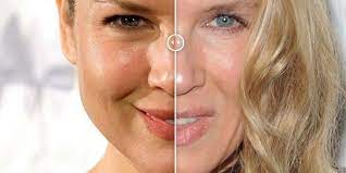 Zellweger first gained widespread attention for her role in the film jerry maguire (1996), and subsequently. Renee Zellweger Still Insists Original Face And Caitlyn Jenner Sues For Accident Movie Tv Tech Geeks News