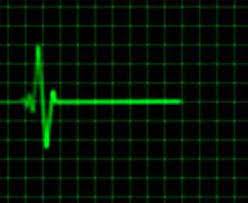 Animated Heart Rate Monitor Electrocardiogram The Heart Sounds Like A Timpani And Sounds Like That Because The Heart Rate Monitor Animated Heart Heart Rate