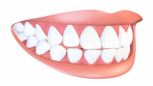 Behandlung Kfo Roloff