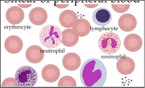 In the blood is clearly both of these— especially the latter. Blood Film Morphology Medicalnigeria Com For Medical And Healthcare Professionals