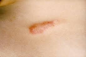 5,032 likes · 5 talking about this. What Causes Scarring Researchers Now Know Time