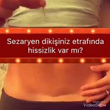 Yrd Doc Dr Gokcenerdogan On Instagram Canlarim Bilgilendirme Bu Egzersizler Ile Sezaryen Yeriniz Ve Komsulugundaki Hissi Food Instagram Instagram Posts