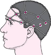 A seizure may also cause a lapse in awareness, called an absence seizure. Seizure Disorders Brain Spinal Cord And Nerve Disorders Msd Manual Consumer Version