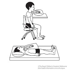 How long does it take for your chipped elbow to heal? Kids Health Information Fracture Care Supracondylar Elbow