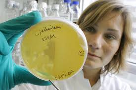 Forschung gegen Achselschweiß: Dufte Idee