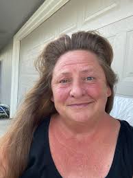 Do treated fence boards lose chemicals over time?