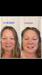 Lifewave x39 patch update., Here is what I have noticed for myself:, 🌼 My  consistent energy where I do not feel exhausted by 11am or needing to sleep  until 10/11am Saturday morning to feel refreshed., ...