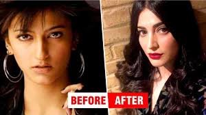 Photos Shruti Hassan Who Was Seen Before Coming To Films Surgery Changed Luck Justnewsly Plastic surgeon marketing & web design by influx. photos shruti hassan who was seen