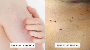 Petechia dots routinely emerge in the lower leg region, but you can experience red spot distribution all over. Skin Rash 7 Causes Of Red Spots And Bumps With Pictures Allure