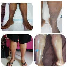 It's part of a large conglomerate that also owns keurig and dozens of other brands. Dr Sandy Medical Spa Aesthetic Clinics Services Beauty4me