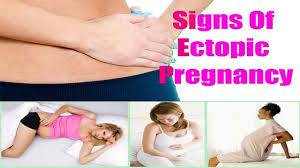 An ectopic pregnancy can initially look like a normal one, but as it progresses, it can be painful and will need to be terminated. Ectopic Pregnancy Symptoms Signs Treatment Youtube