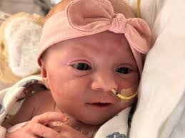 Fundraiser for Lexi Taylor by Alyssa Ballard : Support Greta's Heart  Surgery Journey