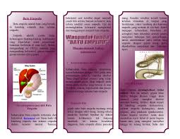 Karena makanan tidak dicampur cairan empedu. Leaflet Batu Empedu