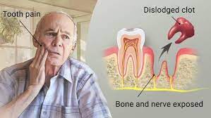 Pin On Dental Surgery