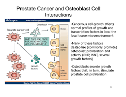 Symptoms of prostate cancer in men include bladder and urinary problems that result in: Nursing 203 Prostate Cancer Flashcards Quizlet