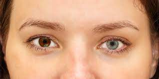 Por Que Estan Cambiando De Color Mis Ojos American Academy Of Ophthalmology