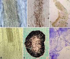 Tube de vidéo porno de bestialité avec une large sélection de sexe de zoophilie, cheval sexe, porno chien, sexe avec chien, fille baise avec chien, sexe animal. Common And Emerging Dermatophytoses In Animals Well Known And New Threats Springerlink