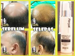Sbb feryal argan oil boleh: Feryal Argan Oil Penawar Rambut Gugur