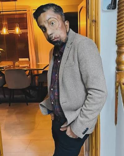“Scarface.”, “Mashed-up face.”, “Oi, Popeye.”, “Captain Hook.”, “Eye eye,  Captain.”, These were just some of the names I grew up with., At some  point, they stopped feeling like insults. Not because ...