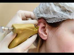 11 Effective Home Remedies To Treat Infected Piercing Boldsky Com