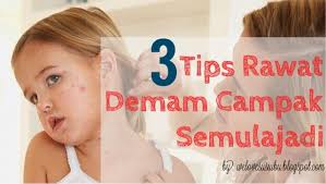 Maybe you would like to learn more about one of these? 3 Tips Merawat Demam Campak Pada Anak Semulajadi Berkesan Hadiah Terindah Dari Ibu Untuk Anaknya