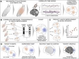 Matt nevala, charleston area manager. A Unified Functional Network Target For Deep Brain Stimulation In Obsessive Compulsive Disorder Biological Psychiatry