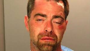 2 Bristol Twp. cops hurt after allegedly drunk man gets behind wheel