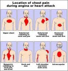 4 Bodily Signs A Heart Attack Is Near Try To Think Of Your Heart As The Car Battery Of Your Body It Sustains It Nursing Care Cardiac Nursing Paramedic School