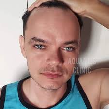 Aquarius clinic (@aquariusclinic) • Instagram photos and videos