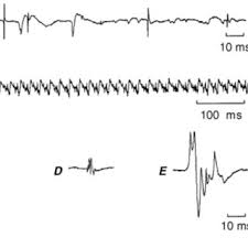 Check spelling or type a new query. 24 Forms Simplified Tai Chi Chuan Download Scientific Diagram
