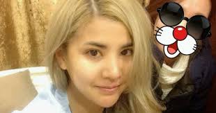 Solongosiin Goo Saihnii Mes Zasliin Emneleg- ''BEFORE&AFTER'': KIM JUNE SUNG  emch- hoh tomruulah mes zasal. Solongosiin goo saihnii B&A emneleg