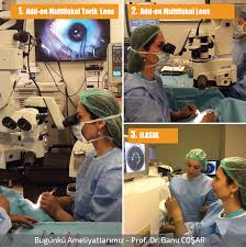 Eskiden Katarakt Ameliyati Olup Sadece Uzak Lensi Taktirmis Olanlara Da 2 Bir Uzak Yakin Birarada Lens Takilabilir Ilk Ameliyatta Takilmis Lens Bilgi Gozluk