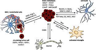 Breast cancer symptoms are important to know with it being the most common cancer in the uk. Breast Cancer Brain Metastases Biology And New Clinical Perspectives Breast Cancer Research Full Text