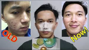 Masker yang berfungsi memutihkan wajah, yaitu merupakan campuran dari putih telur, lemon, serta kunyit bubuk. Dari Untuk Pejuang Jerawat Masker Putih Telur Jeruk Nipis Youtube