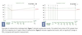 Image result for Inhalation Challenge Test