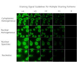 Image result for ANA Staining Pattern
