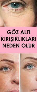 Goz Alti Kirisikliklari Neden Olur Vipbakim Ev Yapimi Cilt Bakimi Gozler Cilt Bakimi