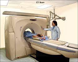 Here's what you need to know. Definition Of Ct Scan Nci Dictionary Of Cancer Terms National Cancer Institute