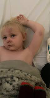 It sent her flying': little girl playing in park…