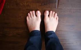 Sebelum ni pernah juga tangan fayyadh sejuk masa demam. 10 Penyebab Telapak Kaki Anda Terasa Dingin Lifestyle Bisnis Com